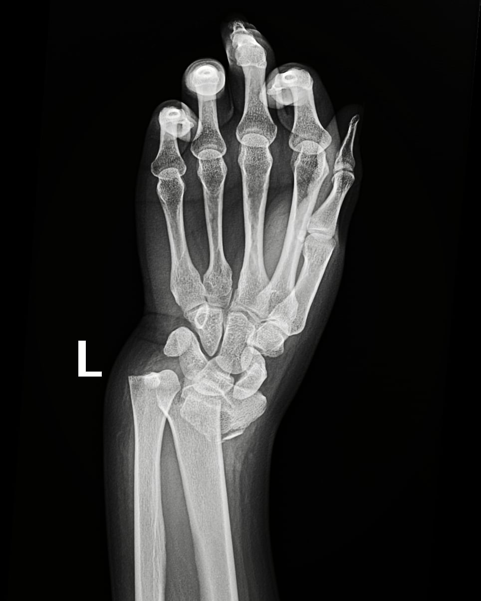 Post Image