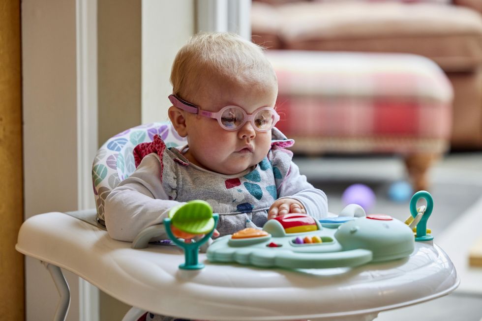 Bilateral Anophthalmia In Newborns: Causes, Diagnosis, And Support Bilateral Anophthalmia In Newborns: Causes, Diagnosis, And Support