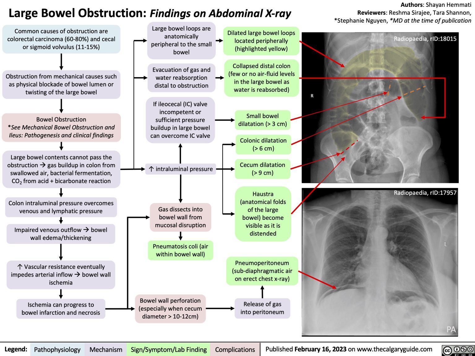 Concerning Findings: Household Plastic Chemicals And Their Potential Impact On Cardiovascular Health Concerning Findings: Household Plastic Chemicals And Their Potential Impact On Cardiovascular Health