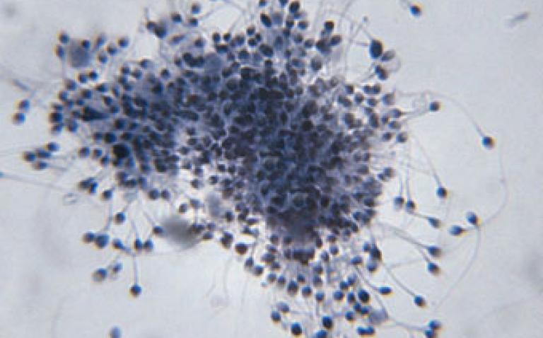 Dissecting Jessica Simpson's Statement On Snake Sperm Consumption Dissecting Jessica Simpson's Statement On Snake Sperm Consumption