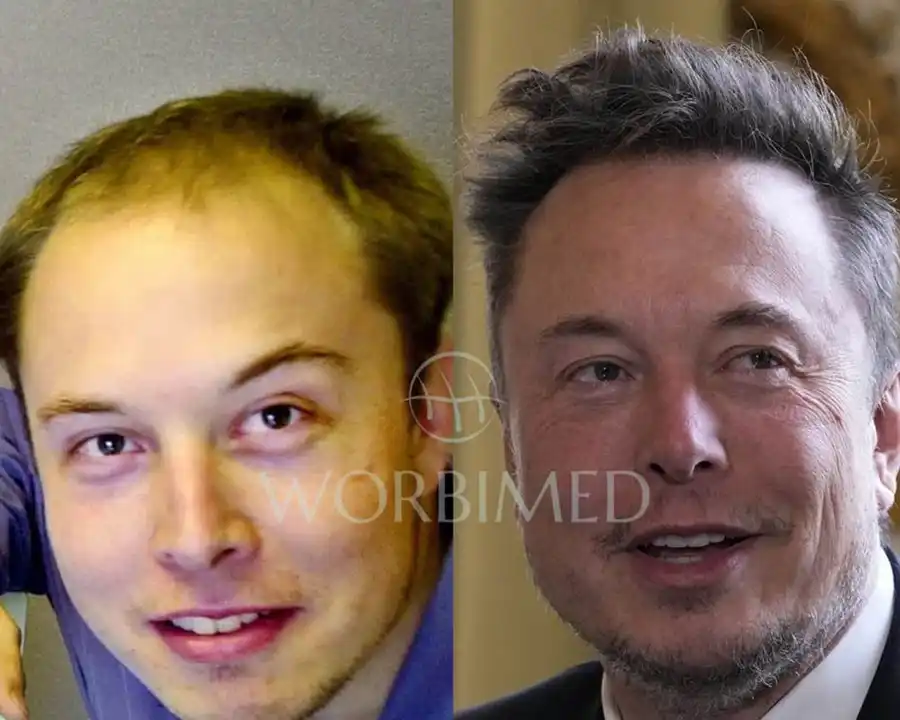 Elon Musk: Back To Business After The Dogecoin Dip Elon Musk: Back To Business After The Dogecoin Dip