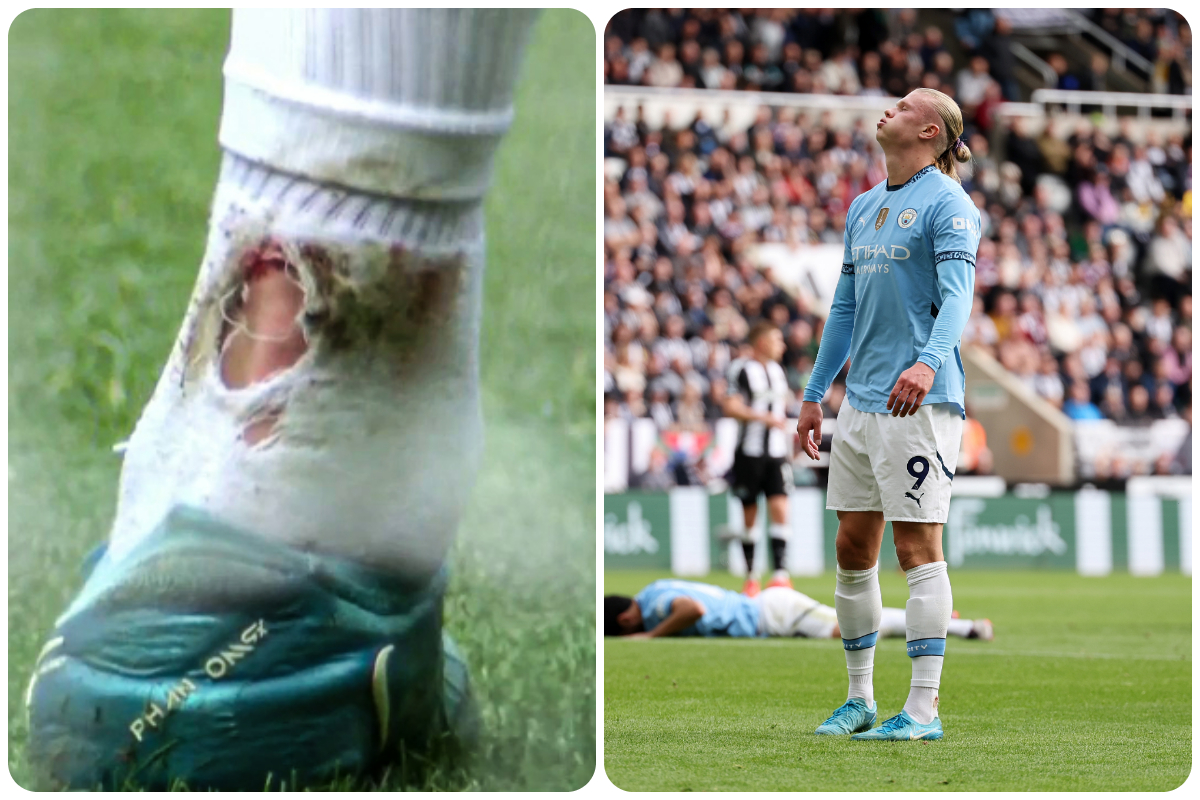 Erling Haaland Injury: Return Date Prediction For Manchester City Erling Haaland Injury: Return Date Prediction For Manchester City