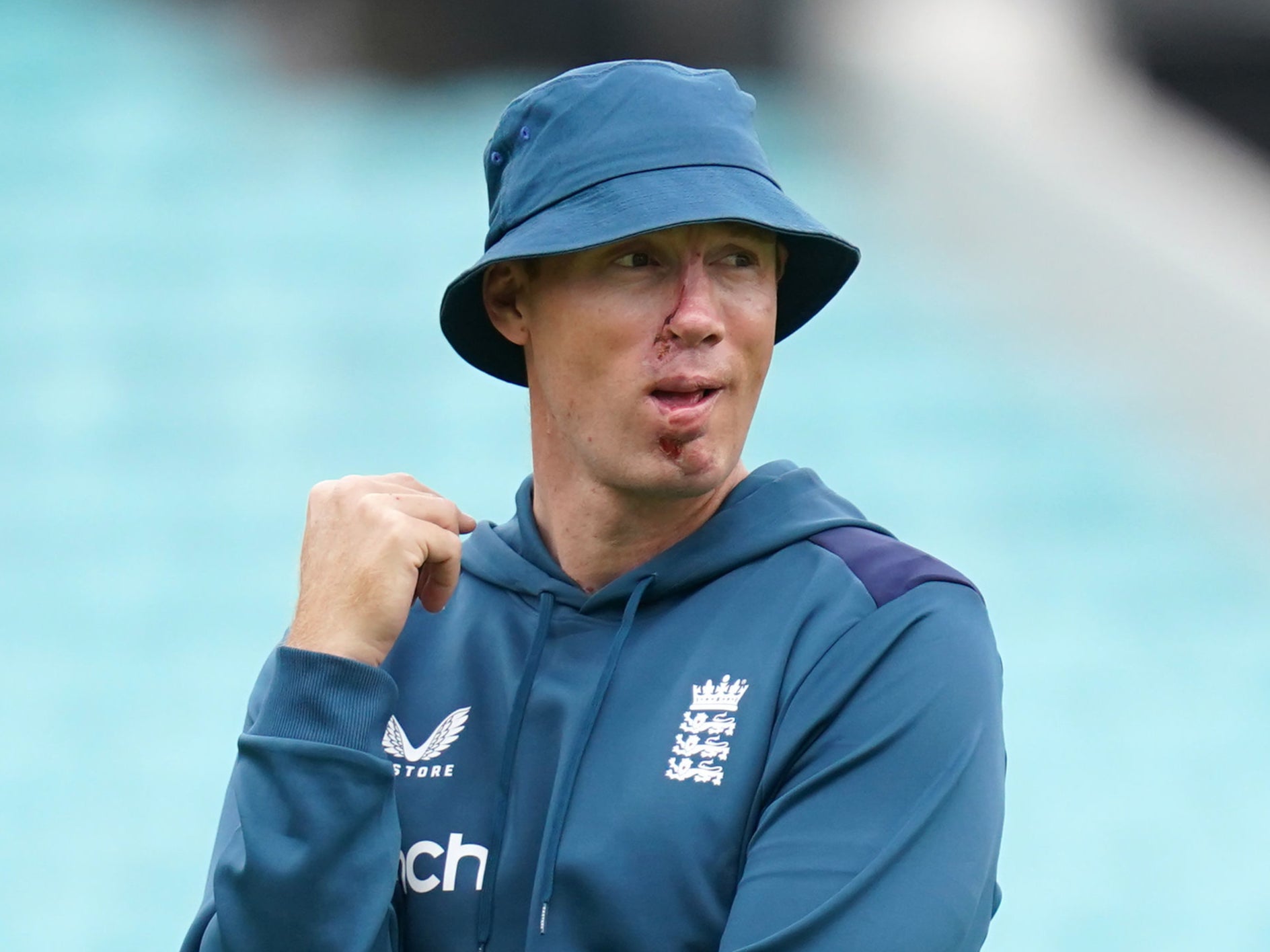 Freddie Flintoff: A Month Off After Devastating Top Gear Accident Freddie Flintoff: A Month Off After Devastating Top Gear Accident