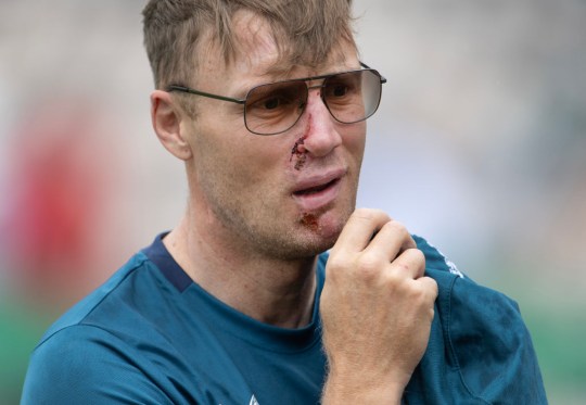 Freddie Flintoff's Car Crash: Freddie Flintoff's Car Crash: