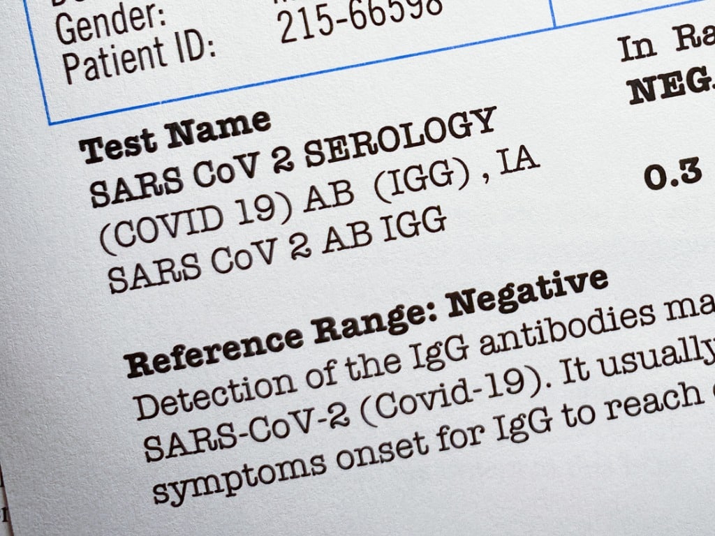 Guilty Plea: Lab Owner Falsified COVID-19 Test Results Guilty Plea: Lab Owner Falsified COVID-19 Test Results