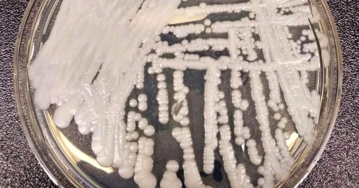 Internal Fungal Infections: A Growing Threat In A Warming World Internal Fungal Infections: A Growing Threat In A Warming World