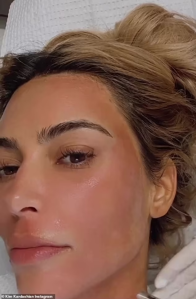 Laser Treatments: Kim Kardashian's Met Gala 2025 Prep Laser Treatments: Kim Kardashian's Met Gala 2025 Prep