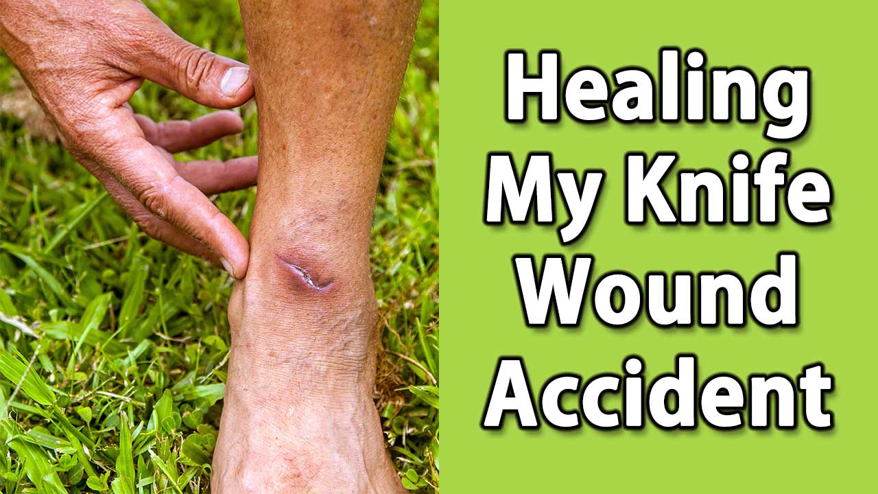 Post Collision Injury Forces Awoniyi Under The Knife Post Collision Injury Forces Awoniyi Under The Knife