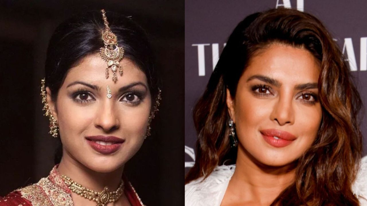 Priyanka Chopra's Nose Job: Her Father's Response Priyanka Chopra's Nose Job: Her Father's Response