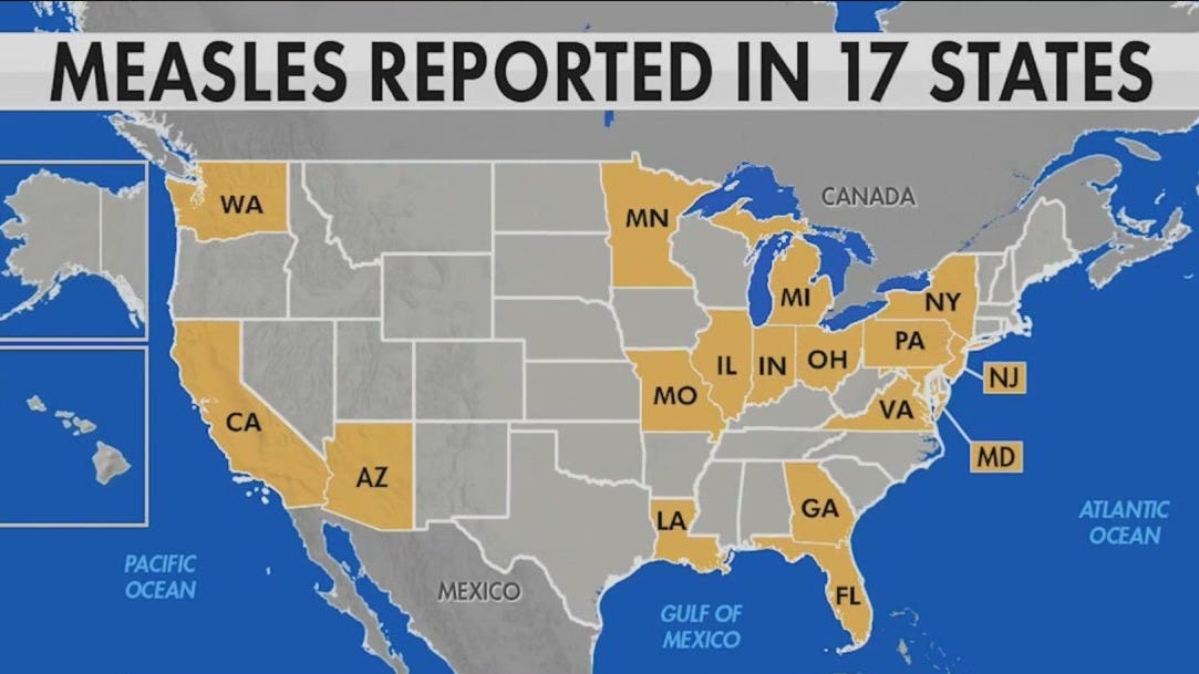 Rising Measles Cases In Kansas: Understanding The Resurgence Rising Measles Cases In Kansas: Understanding The Resurgence