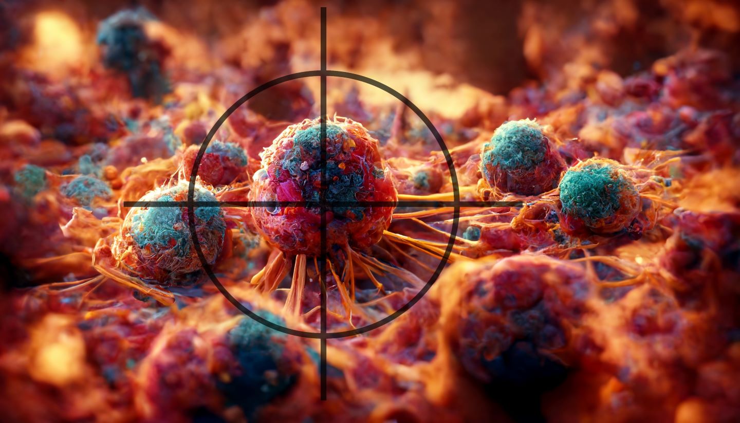 Sanofi's Strategic Acquisition: Deep B-Cell Depletion Technology From Dren Bio Sanofi's Strategic Acquisition: Deep B-Cell Depletion Technology From Dren Bio