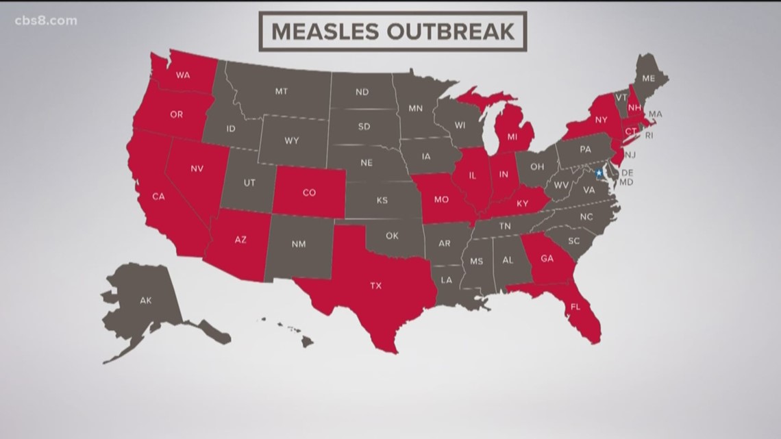 Staying Informed: The Latest On The Measles Outbreak In The United States Staying Informed: The Latest On The Measles Outbreak In The United States