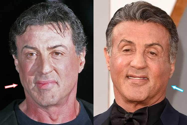 Sylvester Stallone And Coming Home: A Look At His Regretted Decision Sylvester Stallone And Coming Home: A Look At His Regretted Decision