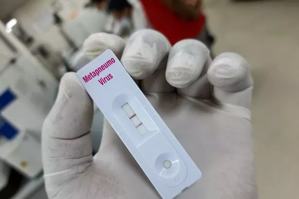 Unraveling The Mystery: A Single Respiratory Virus Linked To Kawasaki Disease Unraveling The Mystery: A Single Respiratory Virus Linked To Kawasaki Disease
